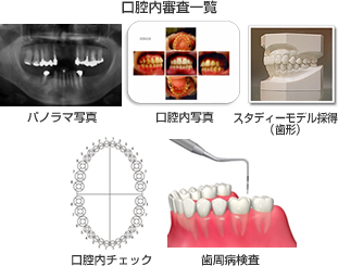 (STEP1)カウンセリングと口腔内検査