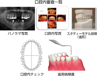 （STEP1）カウンセリングと口腔内検査