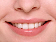 専門家による歯の清掃　PMTC（GMC）